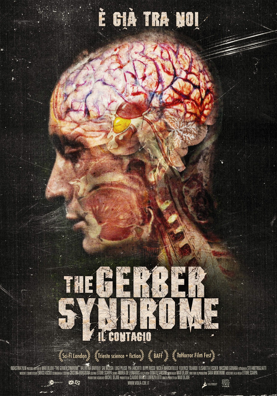 Extra Large Movie Poster Image for The Gerber Syndrome: il contagio 